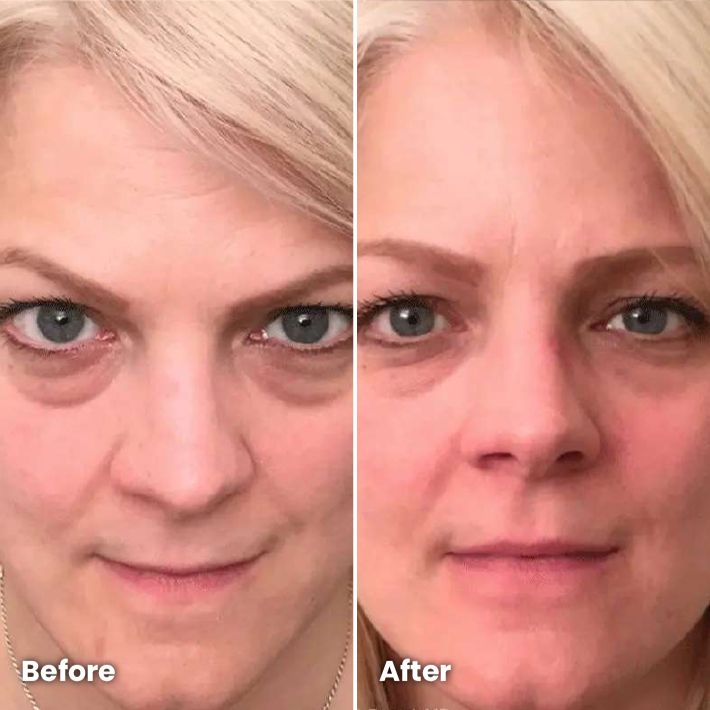 DermaVision™ + FREE SERUM